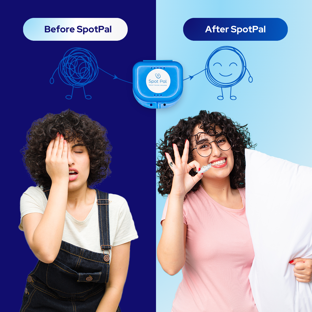 Speech Pal™ Tongue Training Appliance