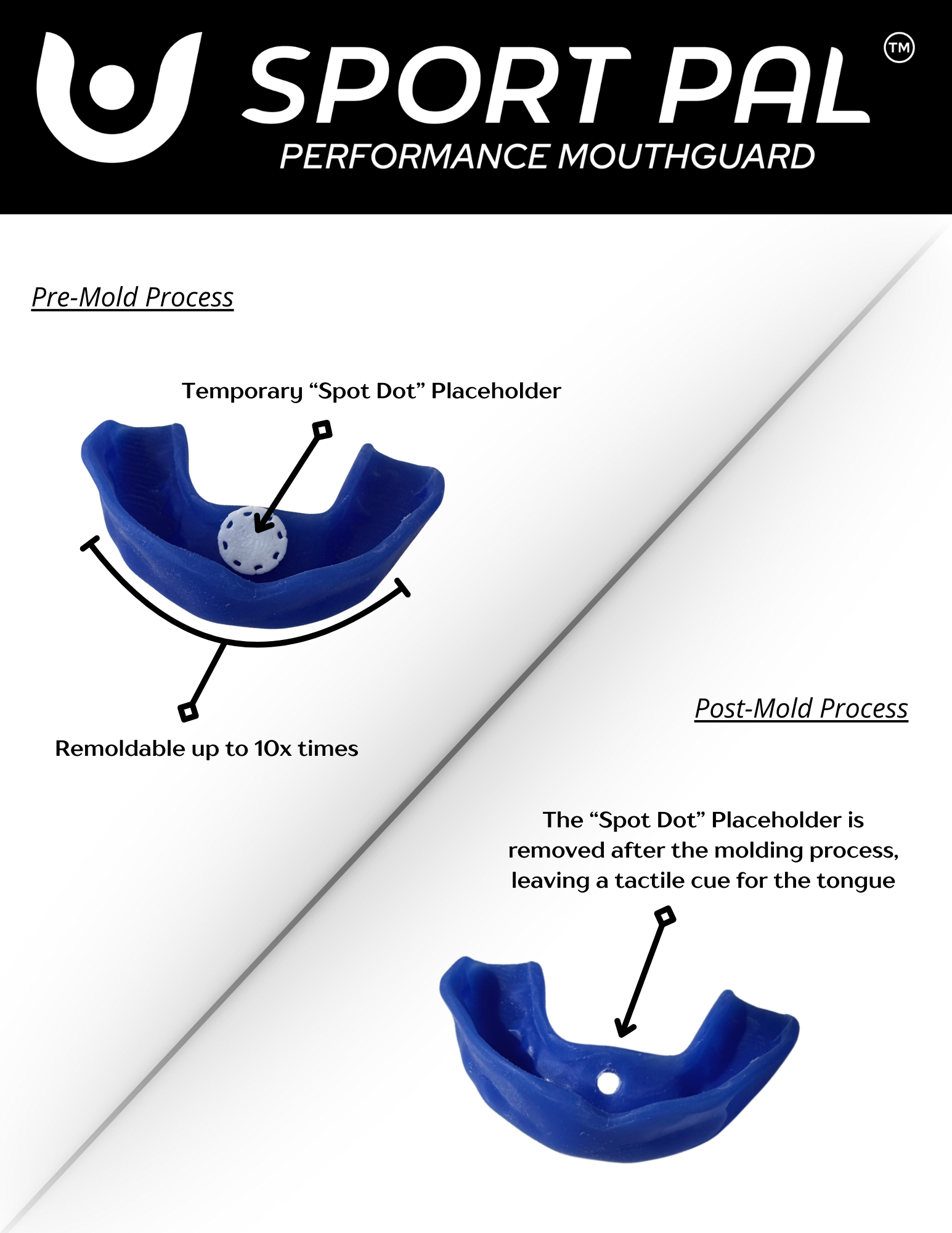 Boil & Bite Sport Pal